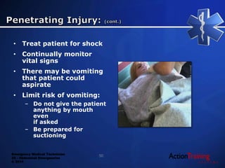Emergency Medical Technician
22 - Abdominal Emergencies
© 2014
• Treat patient for shock
• Continually monitor
vital signs
• There may be vomiting
that patient could
aspirate
• Limit risk of vomiting:
– Do not give the patient
anything by mouth
even
if asked
– Be prepared for
suctioning
50
 