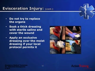 Emergency Medical Technician
22 - Abdominal Emergencies
© 2014
• Do not try to replace
the organs
• Soak a thick dressing
with sterile saline and
cover the wound
• Apply an occlusive
dressing over the moist
dressing if your local
protocol permits it
52
 