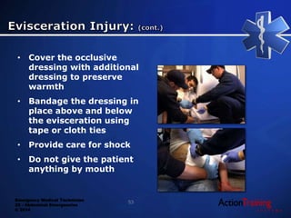 Emergency Medical Technician
22 - Abdominal Emergencies
© 2014
• Cover the occlusive
dressing with additional
dressing to preserve
warmth
• Bandage the dressing in
place above and below
the evisceration using
tape or cloth ties
• Provide care for shock
• Do not give the patient
anything by mouth
53
 