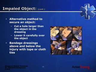 Emergency Medical Technician
22 - Abdominal Emergencies
© 2014
• Alternative method to
secure an object:
– Cut a hole larger than
the object in the
dressing
– Lower it carefully over
the object
• Bandage dressings
above and below the
injury with tape or cloth
ties
58
 