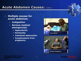 Emergency Medical Technician
22 - Abdominal Emergencies
© 2014
• Multiple causes for
acute abdomen:
– Indigestion
– Serious medical
emergencies:
 Appendicitis
 Peritonitis
 Intestinal obstruction
 Complications from
pregnancy
9
 