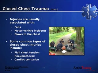 ATS - chest trauma | PPTX