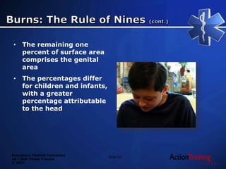Emergency Medical Technician
26 – Soft Tissue Trauma
© 2014
• The remaining one
percent of surface area
comprises the genital
area
• The percentages differ
for children and infants,
with a greater
percentage attributable
to the head
Slide 87
 
