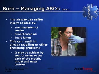 ATS - soft tissue trauma | PPTX