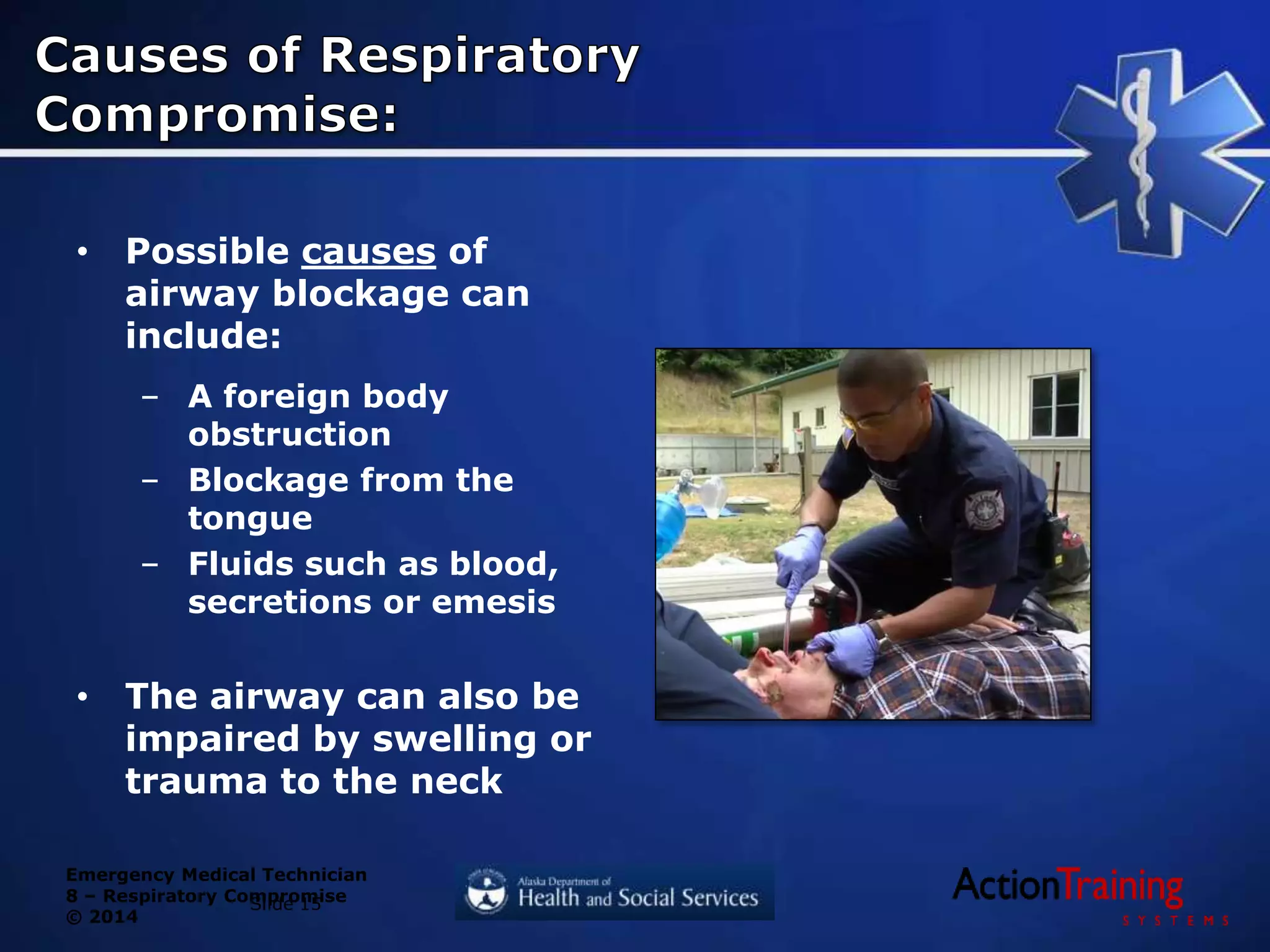 Emergency Medical Technician
8 – Respiratory Compromise
© 2014
• Possible causes of
airway blockage can
include:
– A foreign body
obstruction
– Blockage from the
tongue
– Fluids such as blood,
secretions or emesis
• The airway can also be
impaired by swelling or
trauma to the neck
Slide 15
 