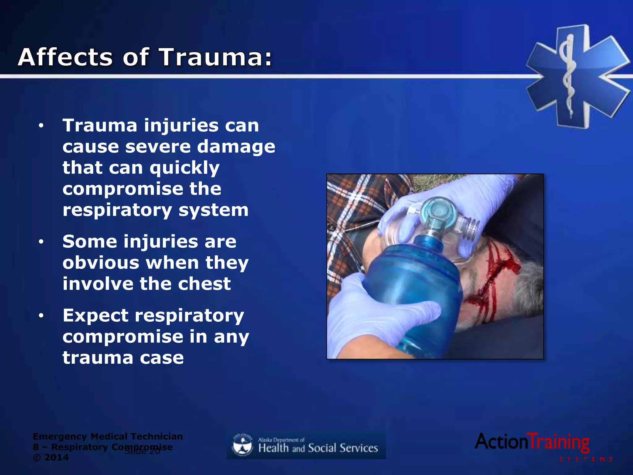Emergency Medical Technician
8 – Respiratory Compromise
© 2014
• Trauma injuries can
cause severe damage
that can quickly
compromise the
respiratory system
• Some injuries are
obvious when they
involve the chest
• Expect respiratory
compromise in any
trauma case
Slide 20
 