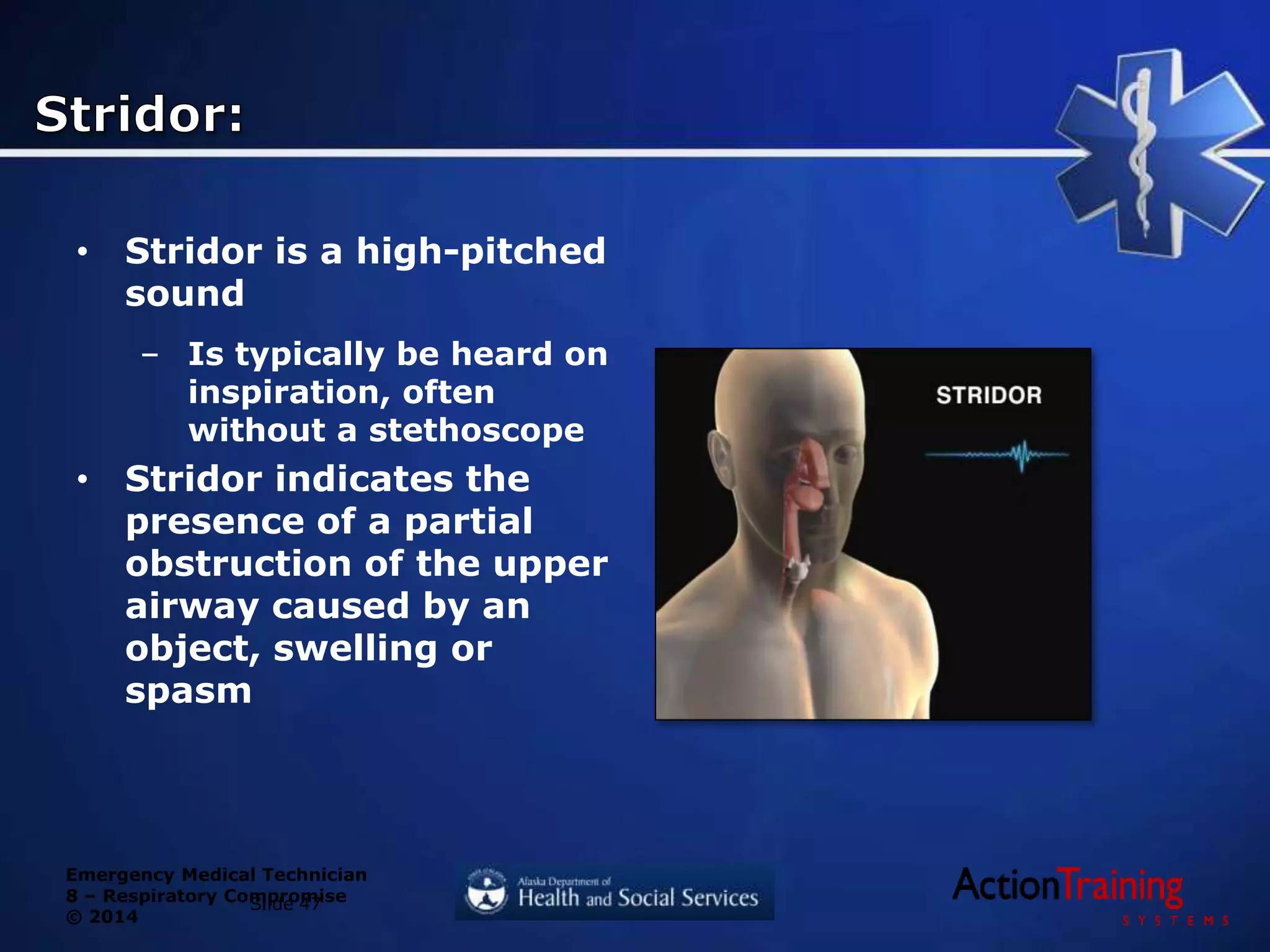 Emergency Medical Technician
8 – Respiratory Compromise
© 2014
• Stridor is a high-pitched
sound
– Is typically be heard on
inspiration, often
without a stethoscope
• Stridor indicates the
presence of a partial
obstruction of the upper
airway caused by an
object, swelling or
spasm
Slide 47
 