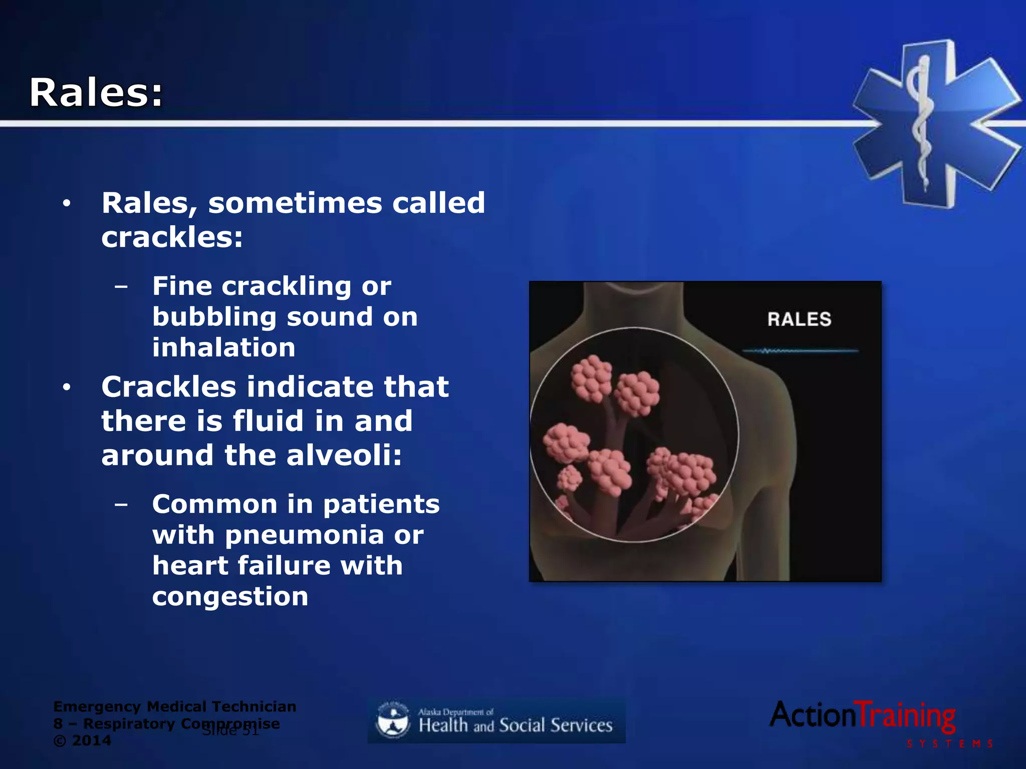Emergency Medical Technician
8 – Respiratory Compromise
© 2014
• Rales, sometimes called
crackles:
– Fine crackling or
bubbling sound on
inhalation
• Crackles indicate that
there is fluid in and
around the alveoli:
– Common in patients
with pneumonia or
heart failure with
congestion
Slide 51
 