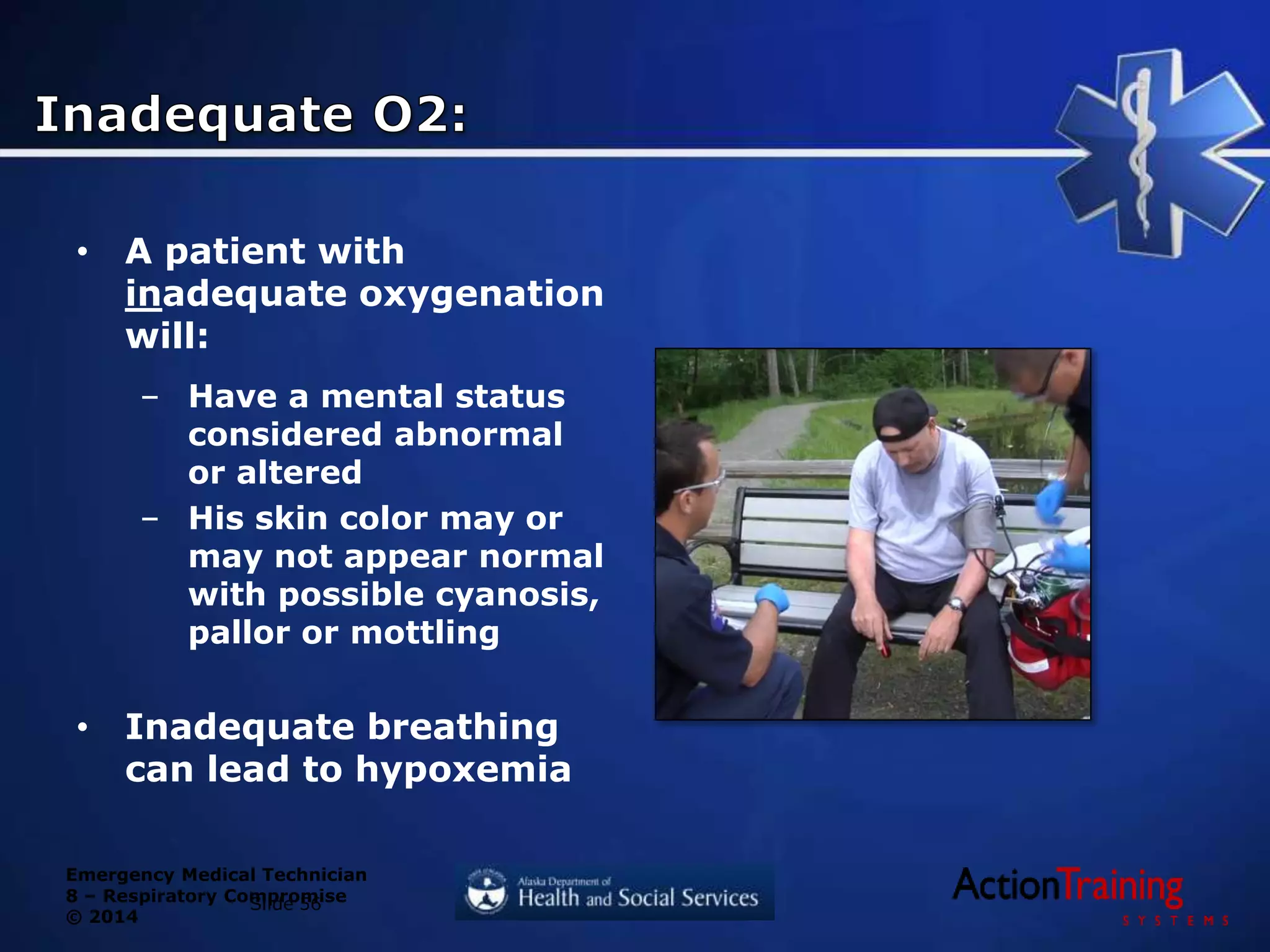 Emergency Medical Technician
8 – Respiratory Compromise
© 2014
• A patient with
inadequate oxygenation
will:
– Have a mental status
considered abnormal
or altered
– His skin color may or
may not appear normal
with possible cyanosis,
pallor or mottling
• Inadequate breathing
can lead to hypoxemia
Slide 56
 