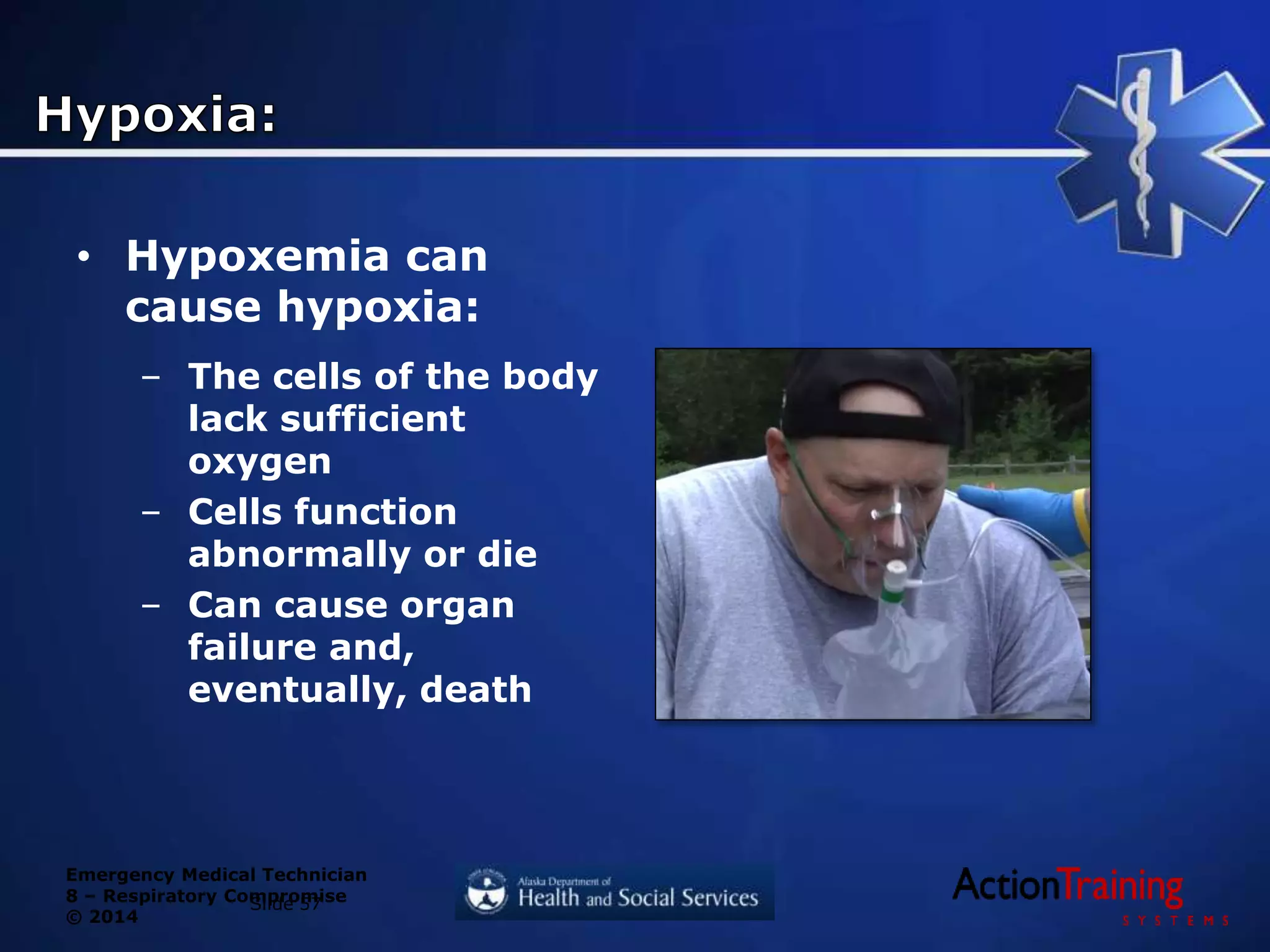 Emergency Medical Technician
8 – Respiratory Compromise
© 2014
• Hypoxemia can
cause hypoxia:
– The cells of the body
lack sufficient
oxygen
– Cells function
abnormally or die
– Can cause organ
failure and,
eventually, death
Slide 57
 