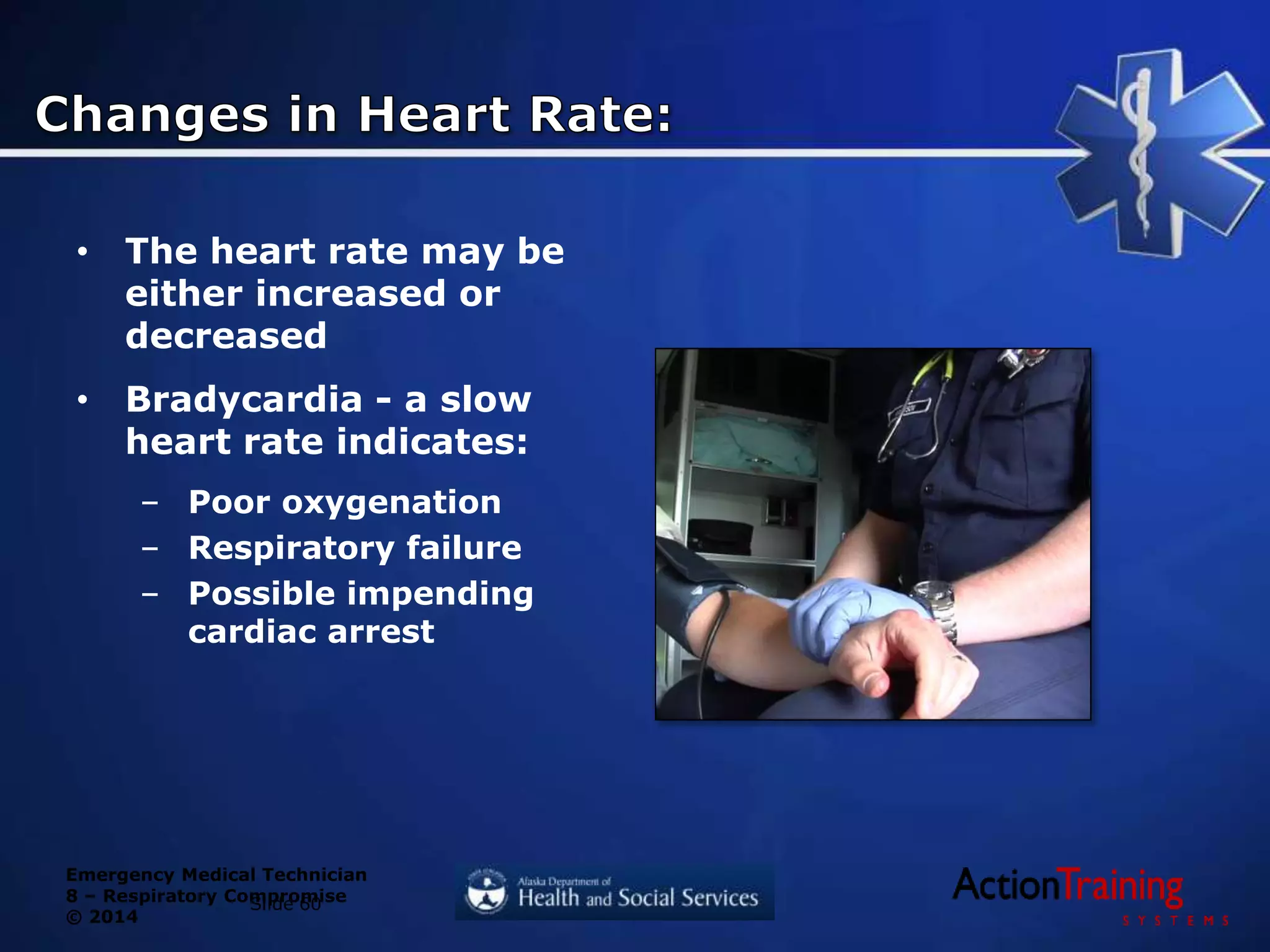 Emergency Medical Technician
8 – Respiratory Compromise
© 2014
• The heart rate may be
either increased or
decreased
• Bradycardia - a slow
heart rate indicates:
– Poor oxygenation
– Respiratory failure
– Possible impending
cardiac arrest
Slide 60
 