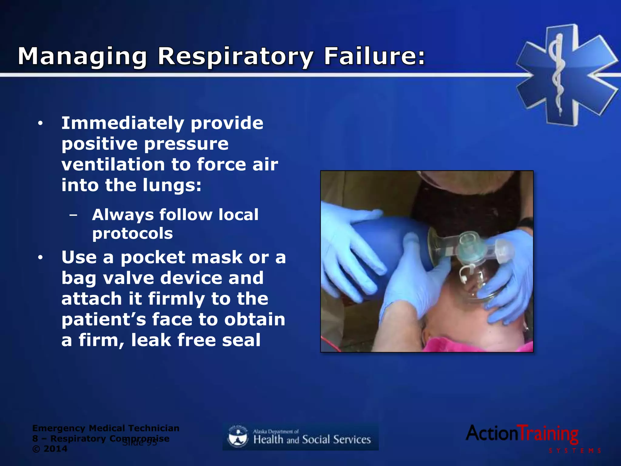 Emergency Medical Technician
8 – Respiratory Compromise
© 2014
• Immediately provide
positive pressure
ventilation to force air
into the lungs:
– Always follow local
protocols
• Use a pocket mask or a
bag valve device and
attach it firmly to the
patient’s face to obtain
a firm, leak free seal
Slide 95
 