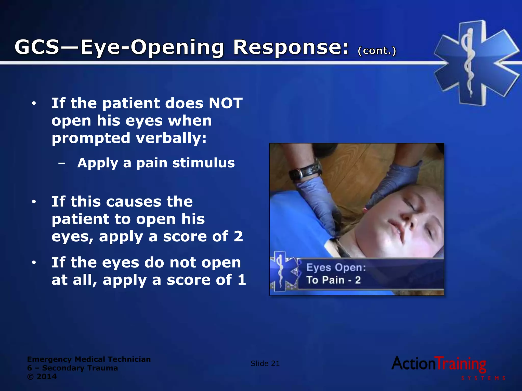Emergency Medical Technician
6 – Secondary Trauma
© 2014
• If the patient does NOT
open his eyes when
prompted verbally:
– Apply a pain stimulus
• If this causes the
patient to open his
eyes, apply a score of 2
• If the eyes do not open
at all, apply a score of 1
Slide 21
 