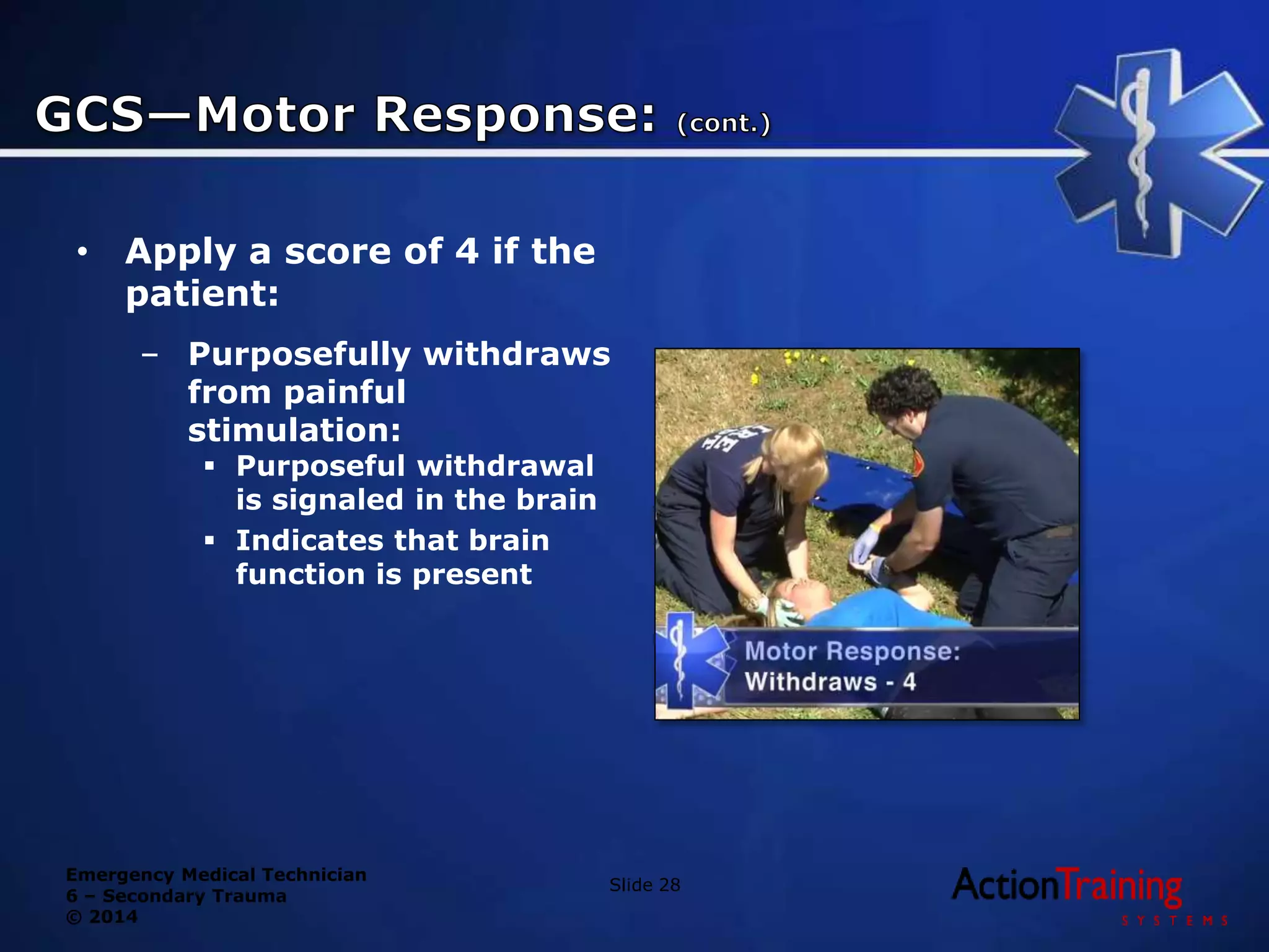 Emergency Medical Technician
6 – Secondary Trauma
© 2014
• Apply a score of 4 if the
patient:
– Purposefully withdraws
from painful
stimulation:
 Purposeful withdrawal
is signaled in the brain
 Indicates that brain
function is present
Slide 28
 