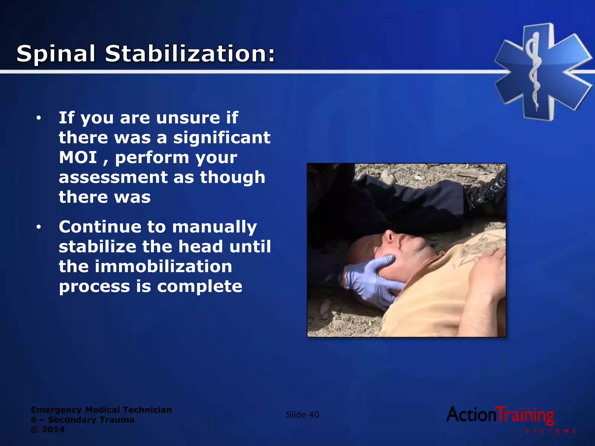 Emergency Medical Technician
6 – Secondary Trauma
© 2014
• If you are unsure if
there was a significant
MOI , perform your
assessment as though
there was
• Continue to manually
stabilize the head until
the immobilization
process is complete
Slide 40
 