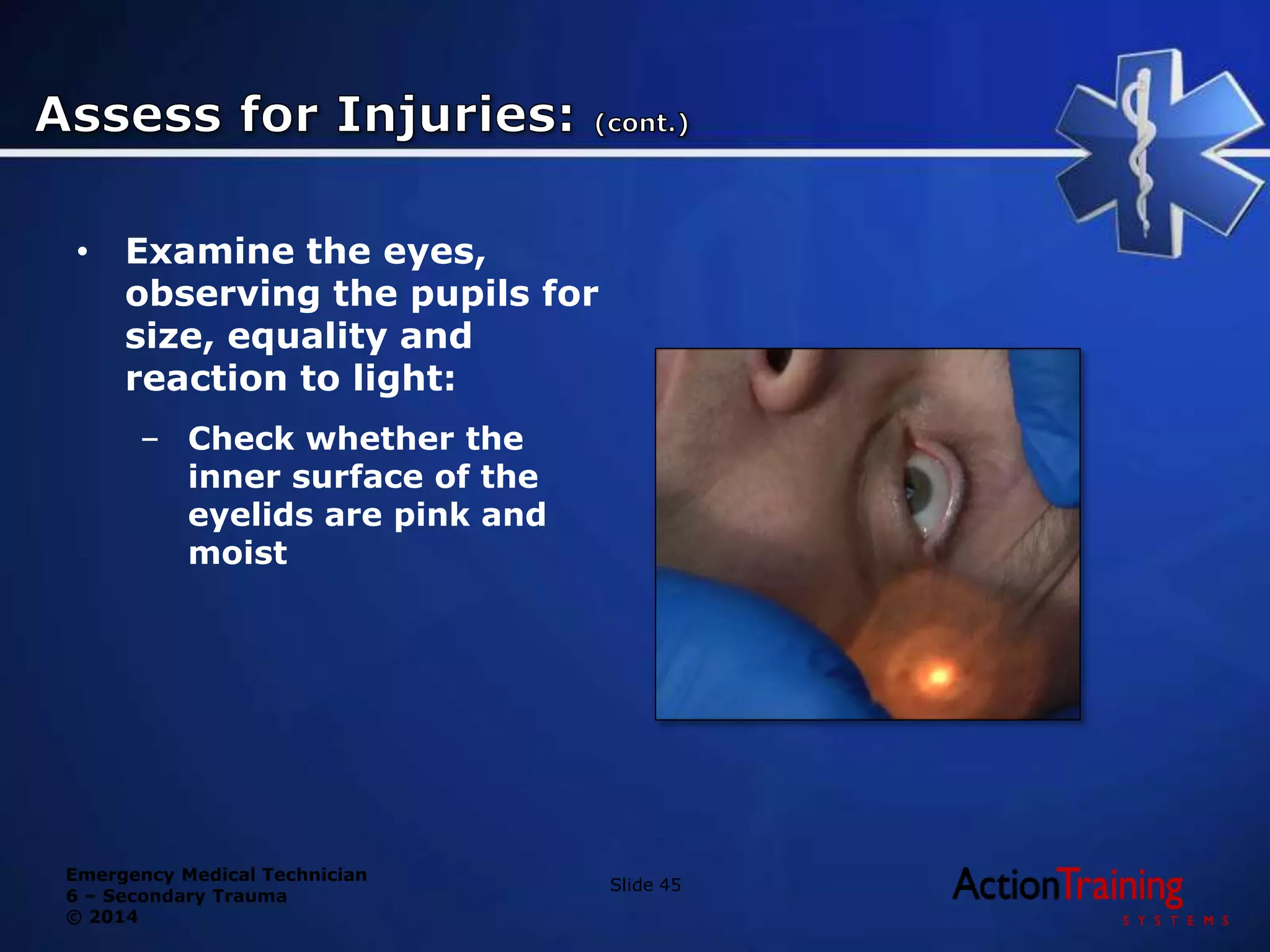 Emergency Medical Technician
6 – Secondary Trauma
© 2014
• Examine the eyes,
observing the pupils for
size, equality and
reaction to light:
– Check whether the
inner surface of the
eyelids are pink and
moist
Slide 45
 