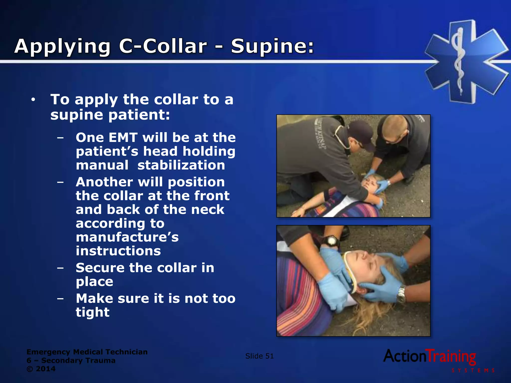 Emergency Medical Technician
6 – Secondary Trauma
© 2014
Slide 51
• To apply the collar to a
supine patient:
– One EMT will be at the
patient’s head holding
manual stabilization
– Another will position
the collar at the front
and back of the neck
according to
manufacture’s
instructions
– Secure the collar in
place
– Make sure it is not too
tight
 