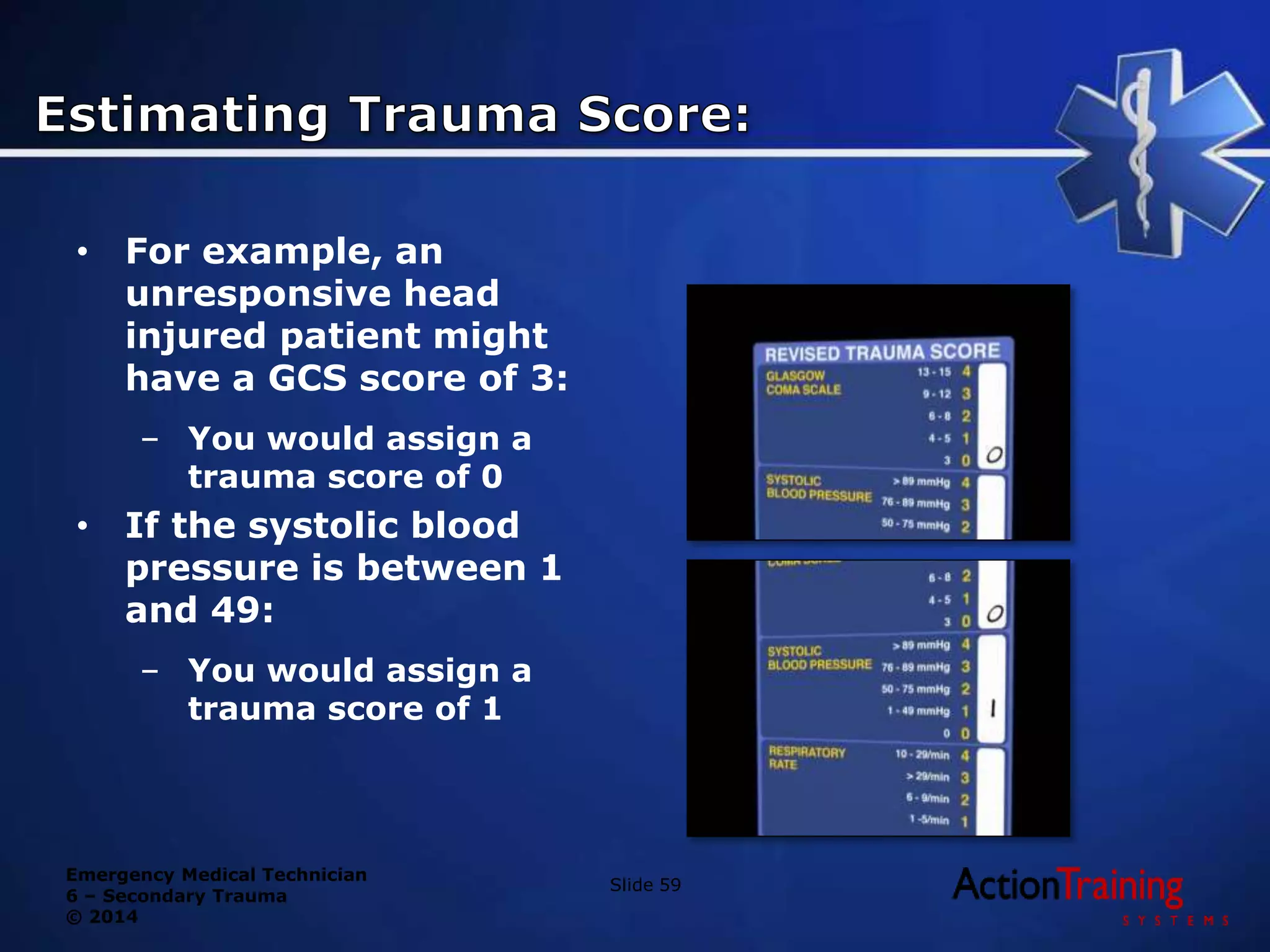 Emergency Medical Technician
6 – Secondary Trauma
© 2014
Slide 59
• For example, an
unresponsive head
injured patient might
have a GCS score of 3:
– You would assign a
trauma score of 0
• If the systolic blood
pressure is between 1
and 49:
– You would assign a
trauma score of 1
 
