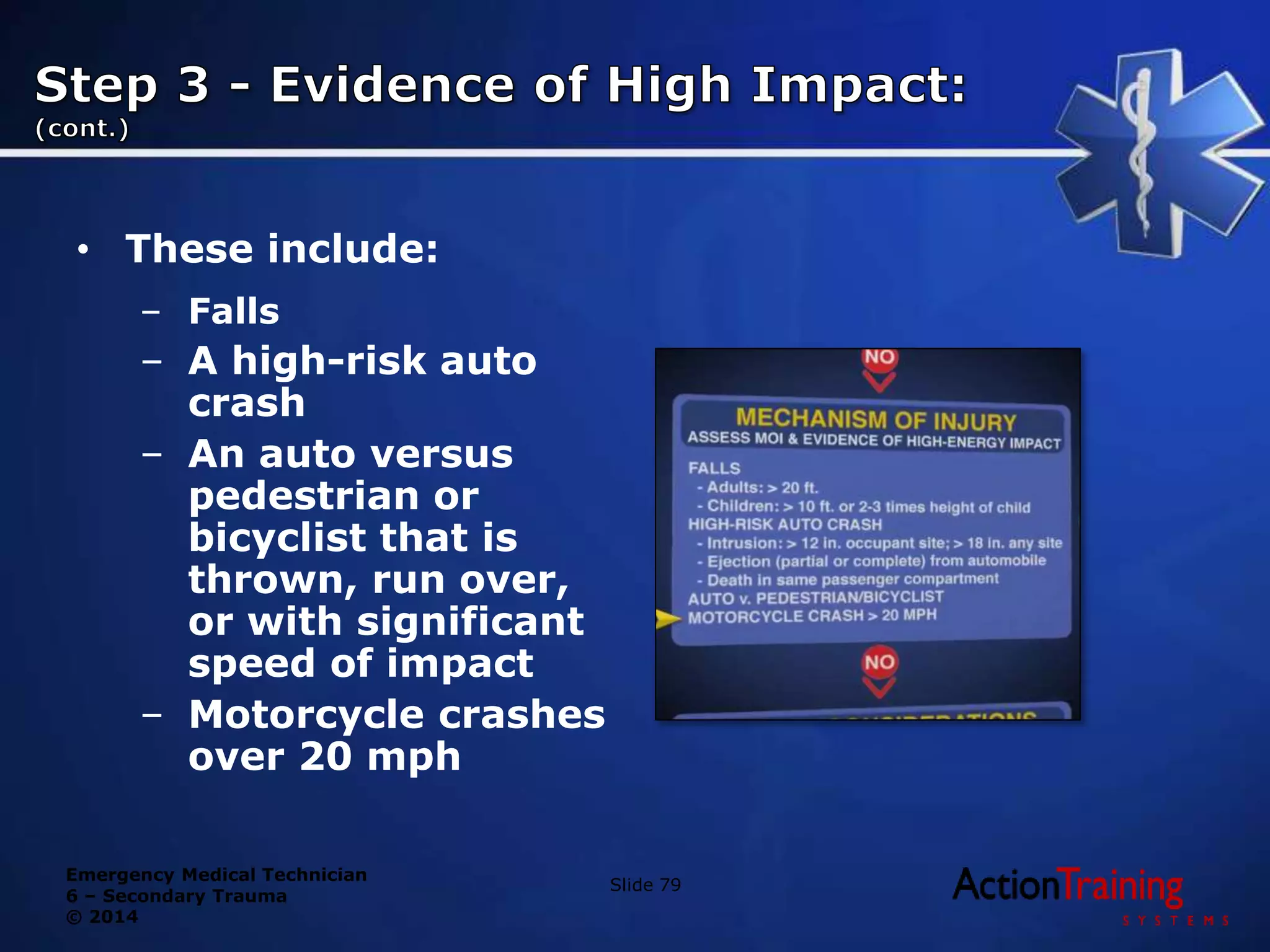 Emergency Medical Technician
6 – Secondary Trauma
© 2014
• These include:
– Falls
– A high-risk auto
crash
– An auto versus
pedestrian or
bicyclist that is
thrown, run over,
or with significant
speed of impact
– Motorcycle crashes
over 20 mph
Slide 79
 