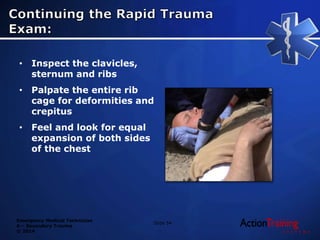 Palpating Ribs ATS - secondary trauma | PPTX