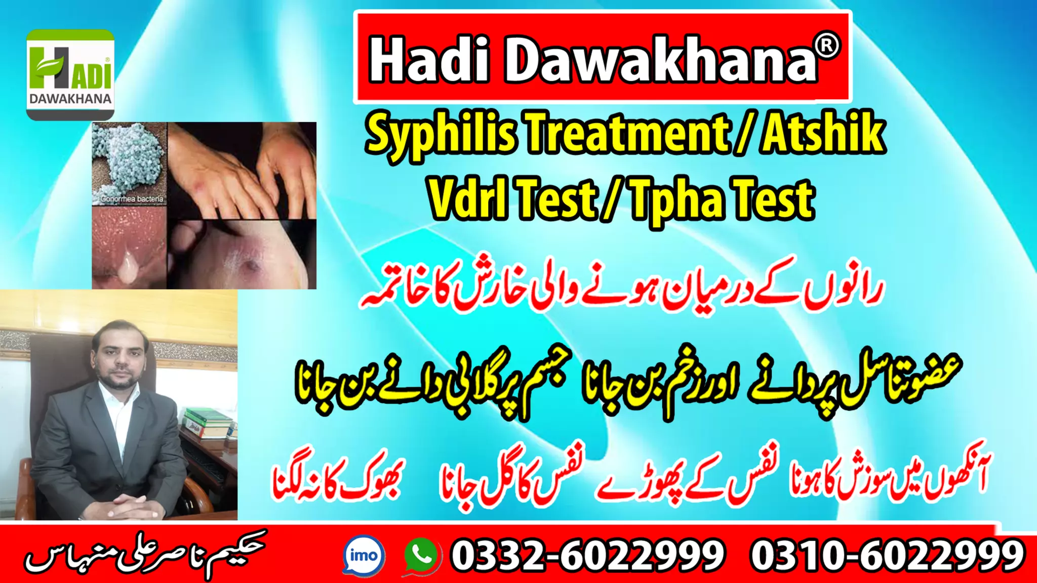 Atshik Ka ILaj / Syphilis Treatment /Vdrl test / Hadi Dawakhana PPT