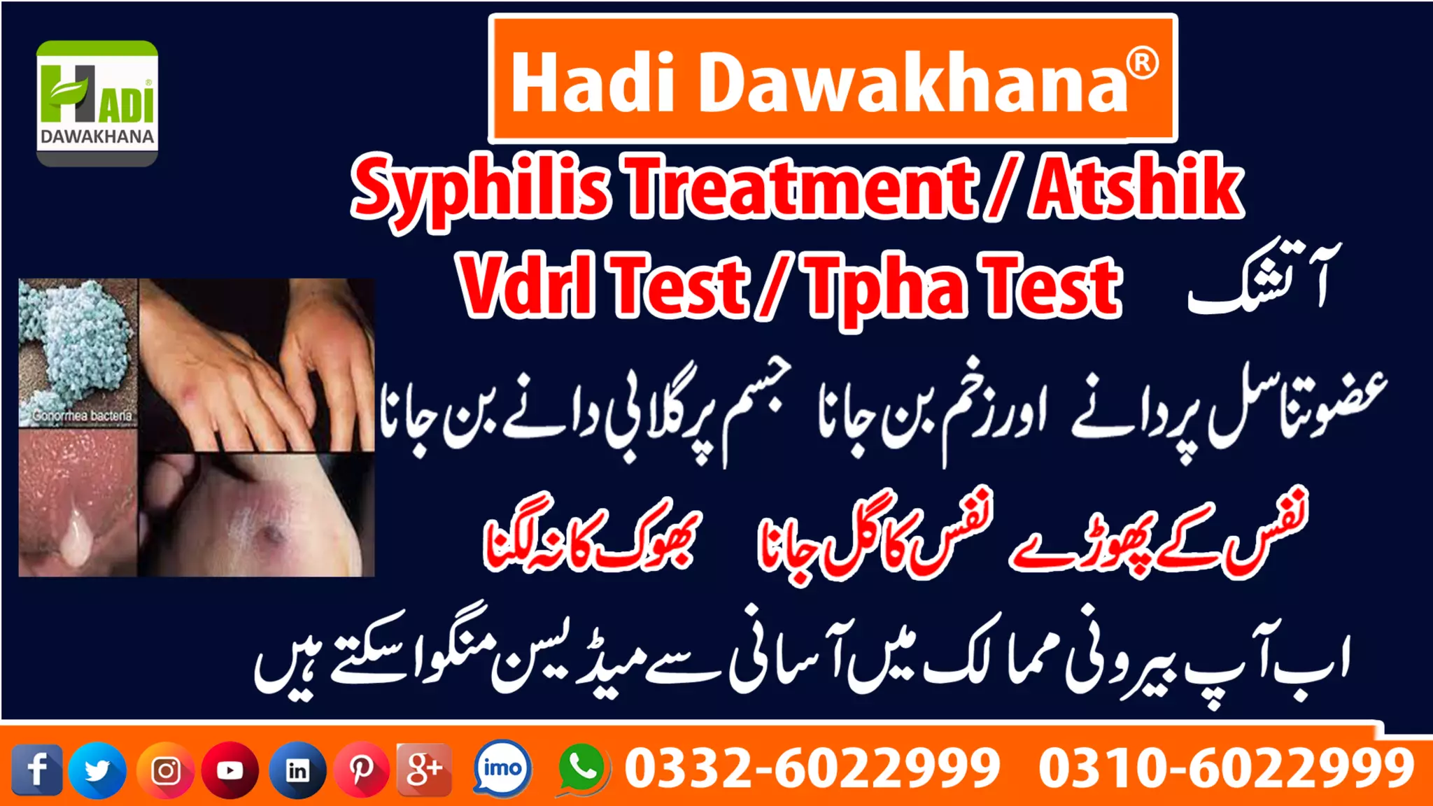 Atshik ka ilaj / Syphilis Treatment / Vdrl test / Hadi dawakhana PPT