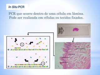 PCR que ocorre dentro de uma célula em lâmina.
Pode ser realizada em células ou tecidos fixados.
 
