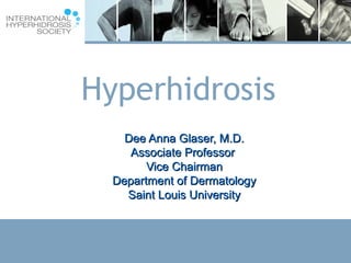 Hyperhidrosis Dee Anna Glaser, M.D. Associate Professor  Vice Chairman Department of Dermatology Saint Louis University 