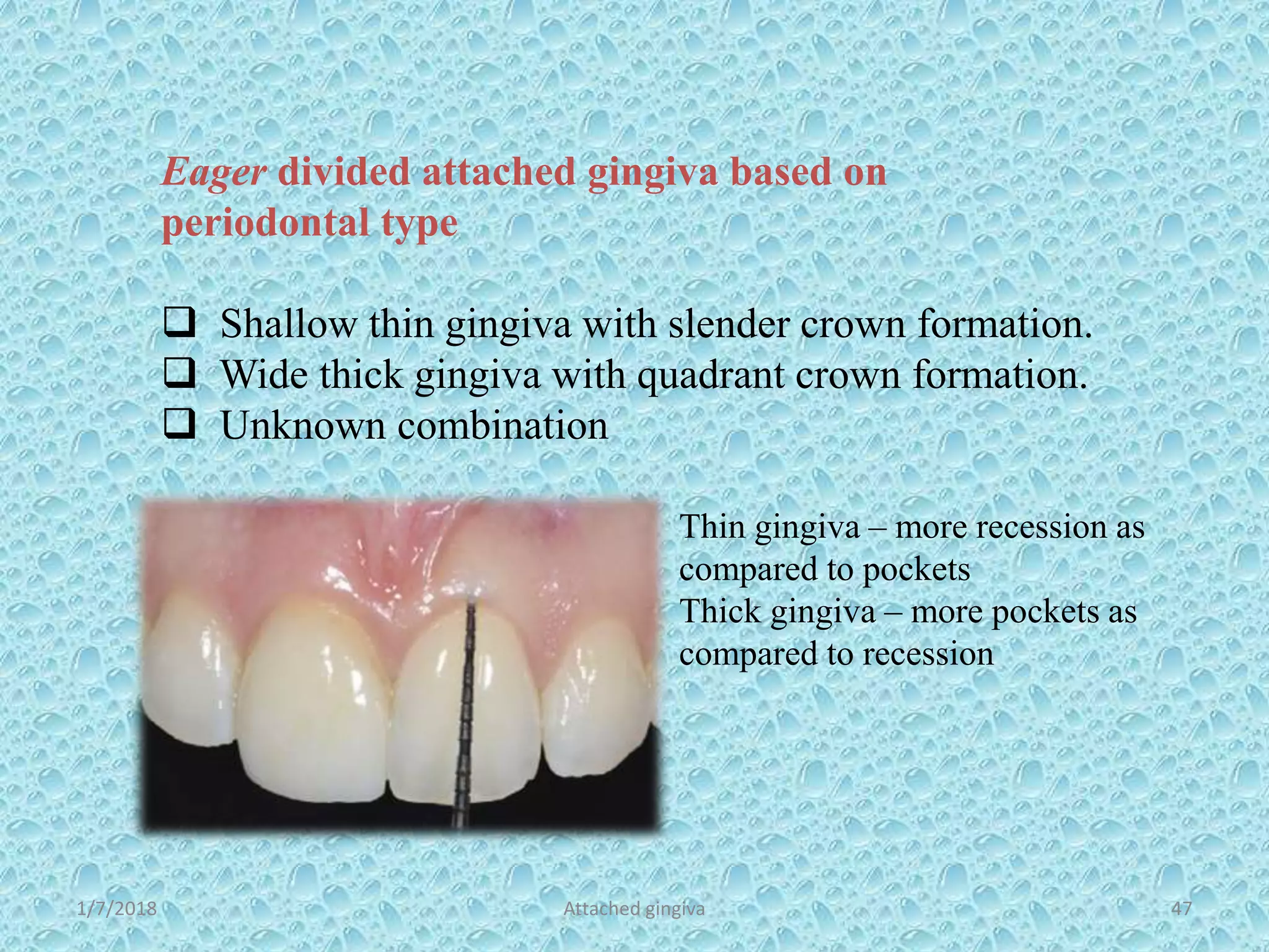 1/7/2018 Attached gingiva 47
Eager divided attached gingiva based on
periodontal type
 Shallow thin gingiva with slender crown formation.
 Wide thick gingiva with quadrant crown formation.
 Unknown combination
Thin gingiva – more recession as
compared to pockets
Thick gingiva – more pockets as
compared to recession
 