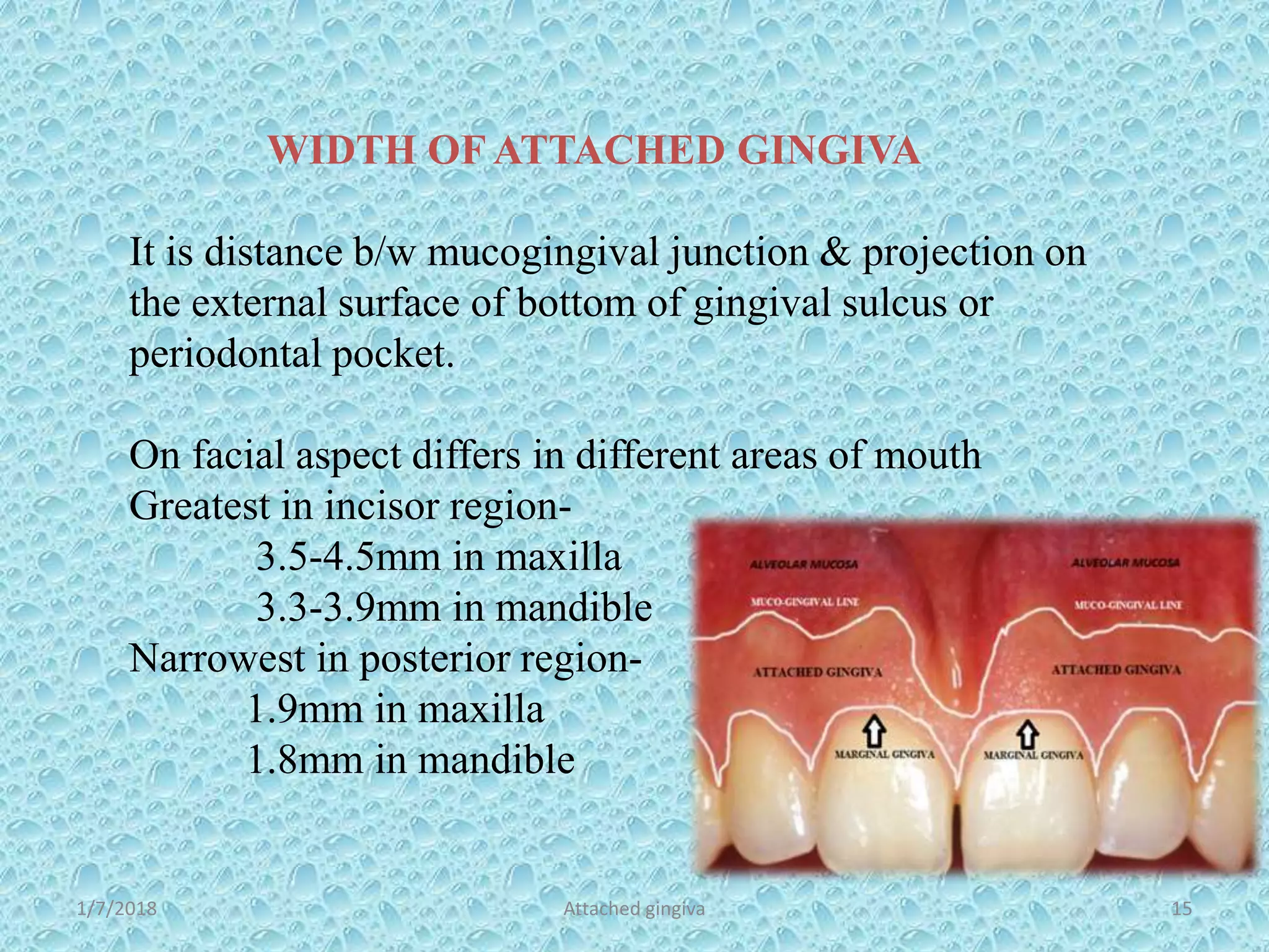 ATTACHED GINGIVA