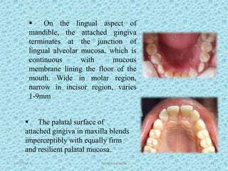  On the lingual aspect of
mandible, the attached gingiva
terminates at the junction of
lingual alveolar mucosa, which is
continuous with mucous
membrane lining the floor of the
mouth. Wide in molar region,
narrow in incisor region, varies
1-9mm
 The palatal surface of
attached gingiva in maxilla blends
imperceptibly with equally firm
and resilient palatal mucosa.
1/7/2018 Attached gingiva 11
 