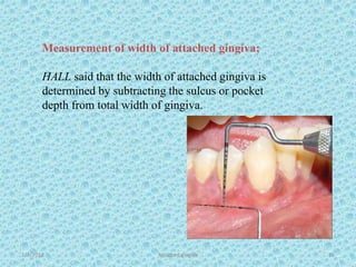 1/7/2018 Attached gingiva 35
Measurement of width of attached gingiva;
HALL said that the width of attached gingiva is
determined by subtracting the sulcus or pocket
depth from total width of gingiva.
 