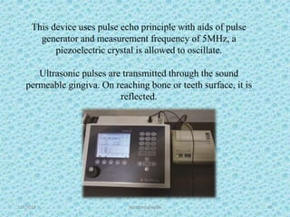 1/7/2018 Attached gingiva 45
This device uses pulse echo principle with aids of pulse
generator and measurement frequency of 5MHz, a
piezoelectric crystal is allowed to oscillate.
Ultrasonic pulses are transmitted through the sound
permeable gingiva. On reaching bone or teeth surface, it is
reflected.
 