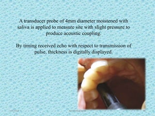 1/7/2018 Attached gingiva 46
A transducer probe of 4mm diameter moistened with
saliva is applied to measure site with slight pressure to
produce acoustic coupling.
By timing received echo with respect to transmission of
pulse, thickness is digitally displayed.
 
