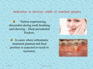 1/7/2018 Attached gingiva 57
Patient experiencing
discomfort during tooth brushing
and chewing – Deep periodontal
Pockets.
In cases where orthodontic
treatment planned and final
position is expected to result in
recession.
Indication to increase width of attached gingiva
 