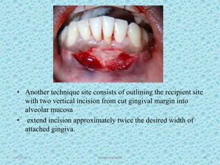 1/7/2018 Attached gingiva 69
• Another technique site consists of outlining the recipient site
with two vertical incision from cut gingival margin into
alveolar mucosa
• extend incision approximately twice the desired width of
attached gingiva.
 