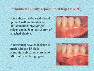 Modified apically repositioned flap (MARF)
1/7/2018 Attached gingiva 76
It is indicated to be used should
present with minimal or no
inflammation, physiologic
sulcus depth, & at least .5 mm of
attached gingiva.
A horizontal beveled incision is
made with a # 15 blade
approximately .5mm coronal to
MGJ into attached gingiva.
 
