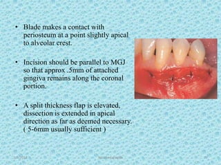 1/7/2018 Attached gingiva 77
• Blade makes a contact with
periosteum at a point slightly apical
to alveolar crest.
• Incision should be parallel to MGJ
so that approx .5mm of attached
gingiva remains along the coronal
portion.
• A split thickness flap is elevated,
dissection is extended in apical
direction as far as deemed necessary.
( 5-6mm usually sufficient )
 