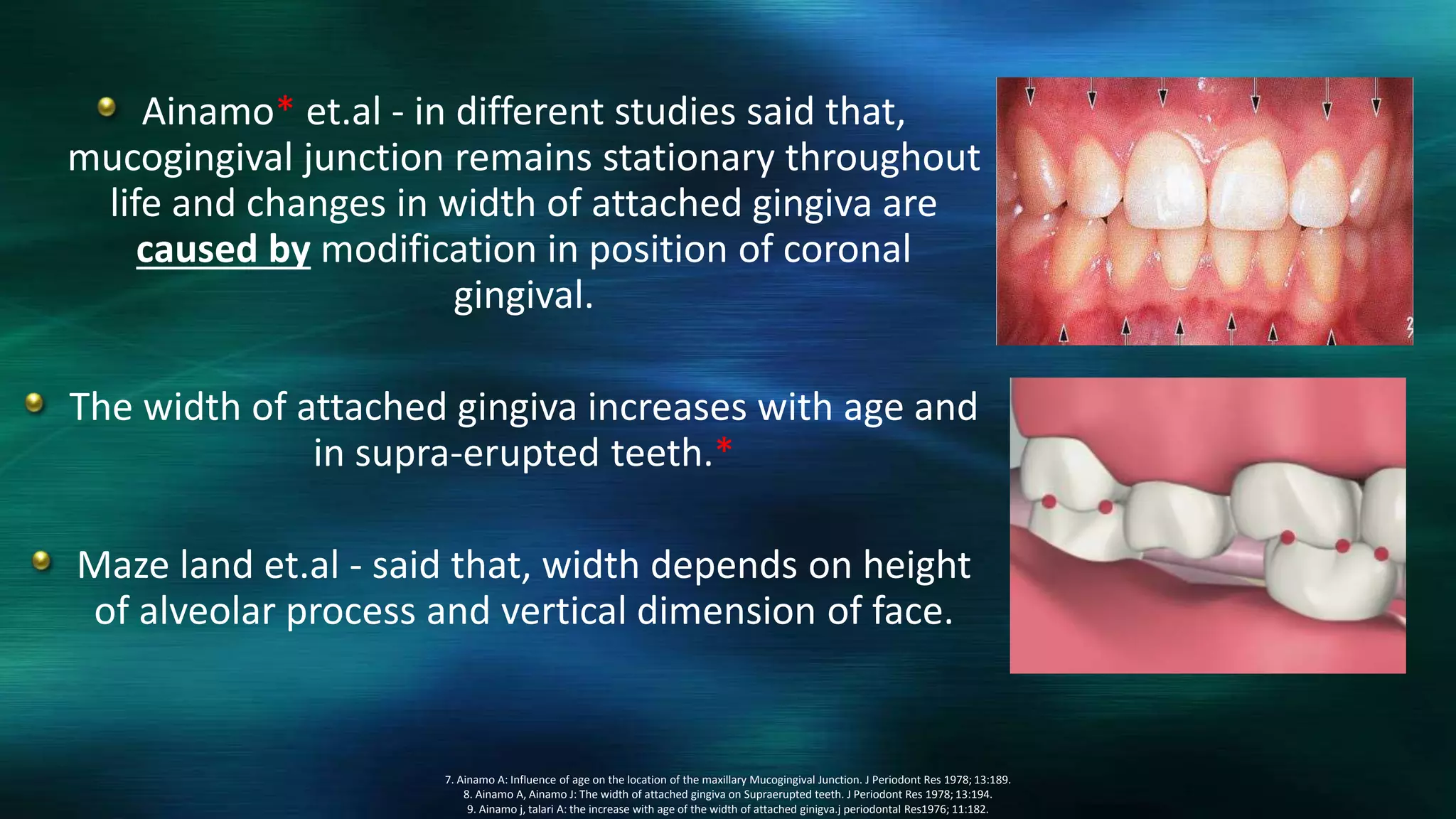 Attached gingiva and its significance