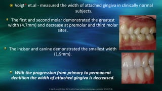 The first and second molar demonstrated the greatest
width (4.7mm) and decrease at premolar and third molar
sites.
The incisor and canine demonstrated the smallest width
(1.9mm).
With the progression from primary to permanent
dentition the width of attached gingiva is decreased.
6. Voigt JP, Goran ML, Flesher RM. The width of lingual mandibular attached gingiva. J periodontol. 1978; 49:77–80.
 Voigt* et.al - measured the width of attached gingiva in clinically normal
subjects.
 