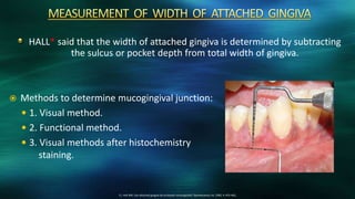 HALL* said that the width of attached gingiva is determined by subtracting
the sulcus or pocket depth from total width of gingiva.
11. Hall WB. Can attached gingiva be increased nonsurgically? Quintessence Int, 1982; 4: 455-462,
 Methods to determine mucogingival junction:
 1. Visual method.
 2. Functional method.
 3. Visual methods after histochemistry
staining.
 