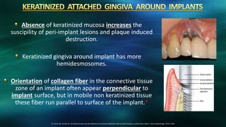Absence of keratinized mucosa increases the
suscipility of peri-implant lesions and plaque induced
destruction.
Keratinized gingiva around implant has more
hemidesmosomes.
Orientation of collagen fiber in the connective tissue
zone of an implant often appear perpendicular to
implant surface, but in mobile non keratinized tissue
these fiber run parallel to surface of the implant.*
17. James RA, Schultz RL: Hemidesmosome and the adhesion of junctional epithelial cells to metal implants a preliminary report, J Oral Implantology; 1974; 4:294.
 