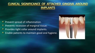 Prevent spread of inflammation.
Prevents recession of marginal tissue.
Provides tight collar around implants.
Enable patients to maintain good oral hygiene.
 