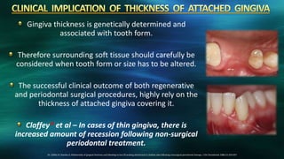 Gingiva thickness is genetically determined and
associated with tooth form.
Therefore surrounding soft tissue should carefully be
considered when tooth form or size has to be altered.
The successful clinical outcome of both regenerative
and periodontal surgical procedures, highly rely on the
thickness of attached gingiva covering it.
Claffey* et al – In cases of thin gingiva, there is
increased amount of recession following non-surgical
periodontal treatment.
24. Claffey N, Shanley D, Relationship of gingival thickness and bleeding to loss Of probing attachment in shallow sites following nonsurgical periodontal therapy. J Clin Periodontal 1986;13: 654-657
 