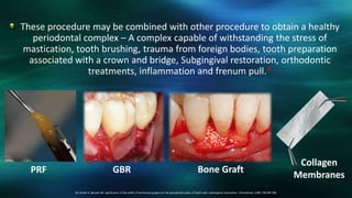 These procedure may be combined with other procedure to obtain a healthy
periodontal complex – A complex capable of withstanding the stress of
mastication, tooth brushing, trauma from foreign bodies, tooth preparation
associated with a crown and bridge, Subgingival restoration, orthodontic
treatments, inflammation and frenum pull.*
28. Stetler K, Bissada NF: significance of the width of keratinized gingiva on the periodontal status of teeth with submarginal restoration, J Periodonto, l1987; 58:696-700,
PRF GBR Bone Graft
Collagen
Membranes
 