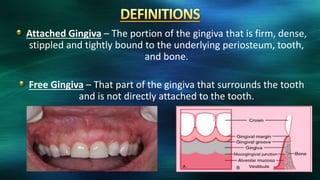 Attached Gingiva – The portion of the gingiva that is firm, dense,
stippled and tightly bound to the underlying periosteum, tooth,
and bone.
Free Gingiva – That part of the gingiva that surrounds the tooth
and is not directly attached to the tooth.
 
