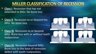 Class I. Recession that has not
extended to MGJ. No bone loss
Class II. Recession to or beyond the
MGJ. No bone loss
Class III. Recession to or beyond
MGJ. Bone loss with or without tooth
malposition.
Class IV. Recession beyond MGJ.
Bone loss to the base of recession
defect with tooth malposition.
 