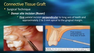 Surgical Technique
Donor site incision (Buser)
First palatal incision perpendicular to long axis of teeth and
approximately 2 to 3 mm apical to the gingival margin.
 