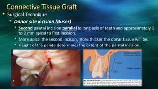 Surgical Technique
Donor site incision (Buser)
Second palatal incision parallel to long axis of teeth and approximately 1
to 2 mm apical to first incision.
More apical the second incison, more thicker the donar tissue will be.
Height of the palate determines the extent of the palatal incision.
 