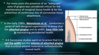 For many years the presence of an “adequate”
zone of gingiva was considered critical for the
maintenance of marginal tissue health & for the
prevention of continuous loss of connective tissue
attachment.
In the early 1980s, Wennstrom et al.* conducted a
series of well-designed experiments to prove that
the attached gingiva and its width, have little role
in maintaining periodontal health.
4-6 Successive studies went on to prove that it is
not the width but the volume of attached gingiva
that is critical around restored or orthodontically
moved teeth.*
1. Wennstrom J.L. Lack of association between width of attached gingiva and development of soft tissue recession: A 5 year longitudinal study. J Clin Periodontol 1987;14: 181-184
2. Wennstrom J.L. Lindhe J, Sinclair F, Thilander B. Some periodontal tissue reactions to orthodontic tooth movement in monkeys. Journal of Clinical Periodontology 1987; 14:121–9.
 